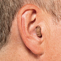 Completely in Canal Hearing Aid