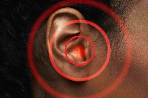 Professional performing ear wax removal at a hearing center